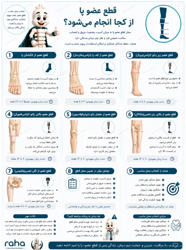 قطع عضو پا از کجا انجام می‌شود؟