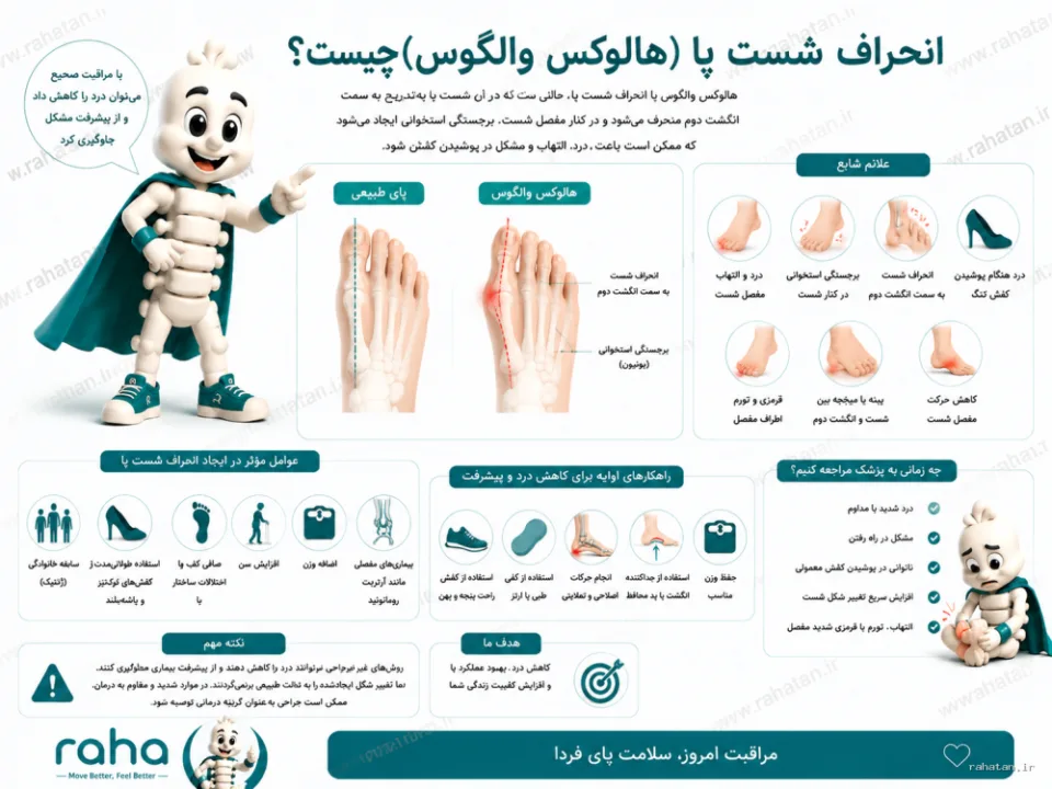 انحراف شست پا یا هالوکس والگوس همراه با شخصیت رها - Rahatan