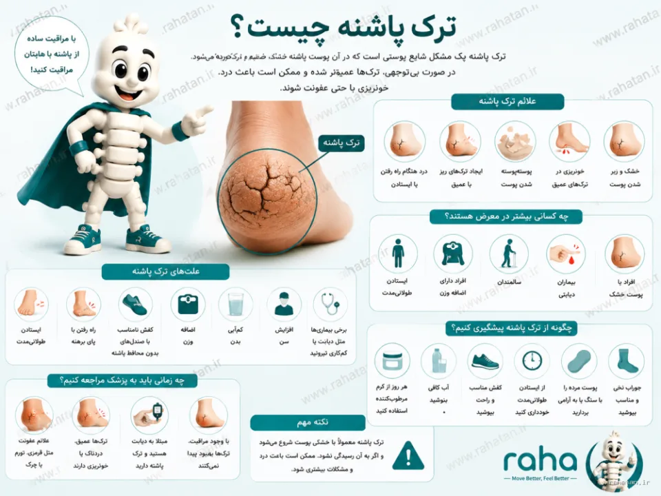 ترک پاشنه