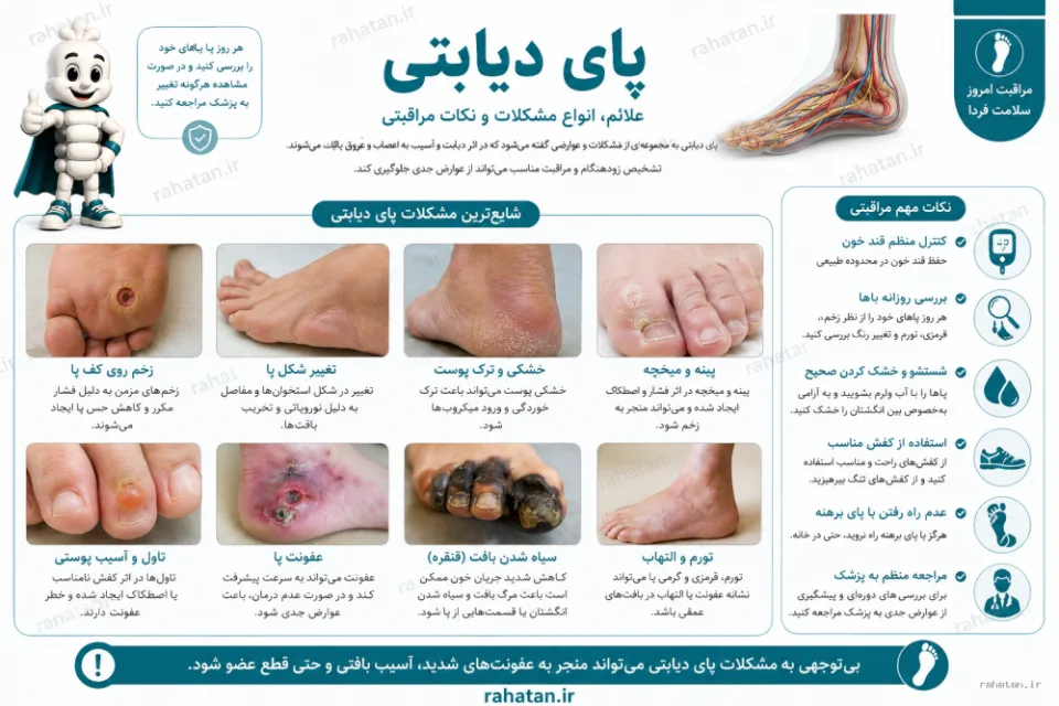 پای دیابتی و علائم زخم و مشکلات پا در افراد مبتلا به دیابت