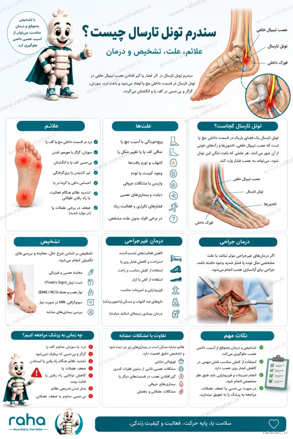 سندروم تونل تارسال