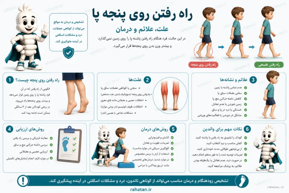 راه رفتن روی سر پنجه پا